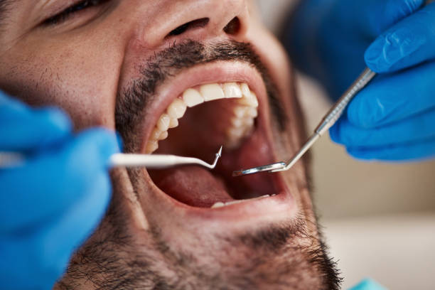 Tooth Infection Emergency Dentist in TX